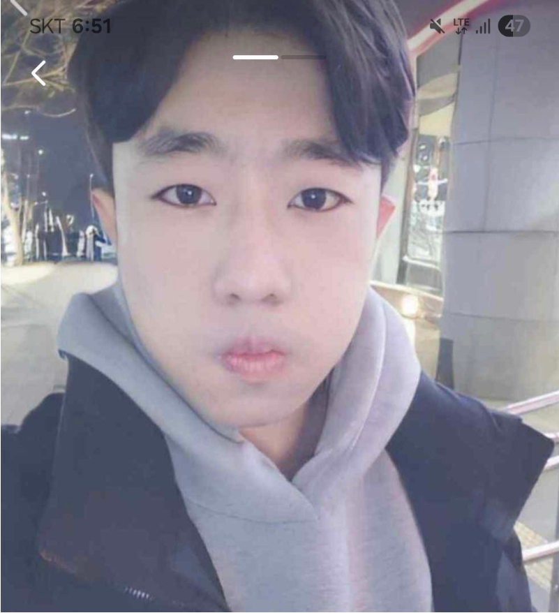 첫 도전!! 나의 비포 에프터 후기 !!