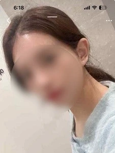 후기 이미지