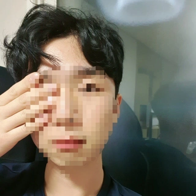 후기 이미지